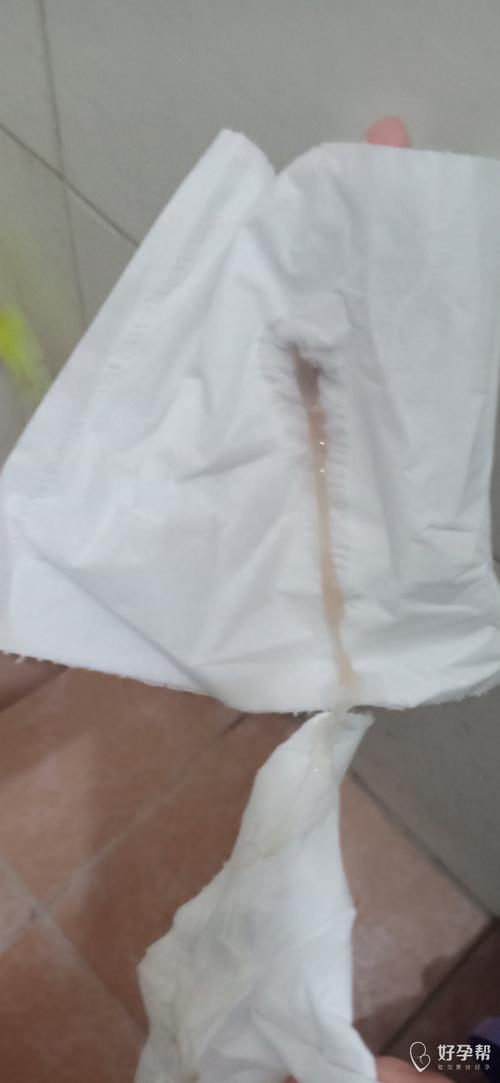 促排卵泡减少