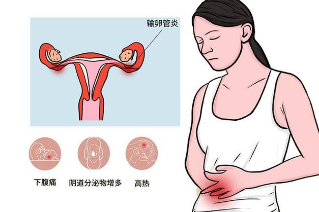 输卵管功能不良
