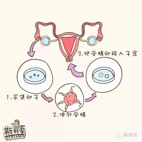试管婴儿、胚胎不成活、生殖医疗