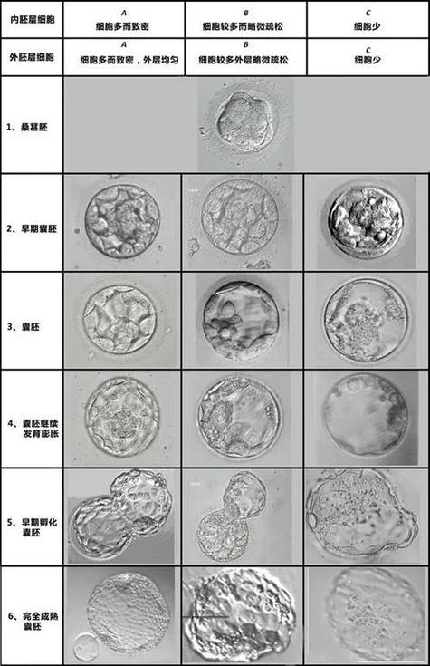 囊胚等级 3bc
