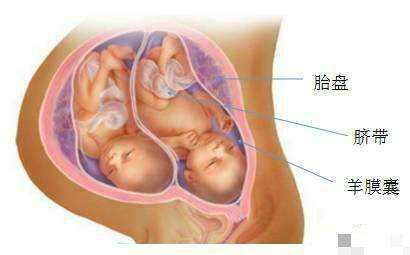 探索试管婴儿技术：如何成功怀孕双胞胎？