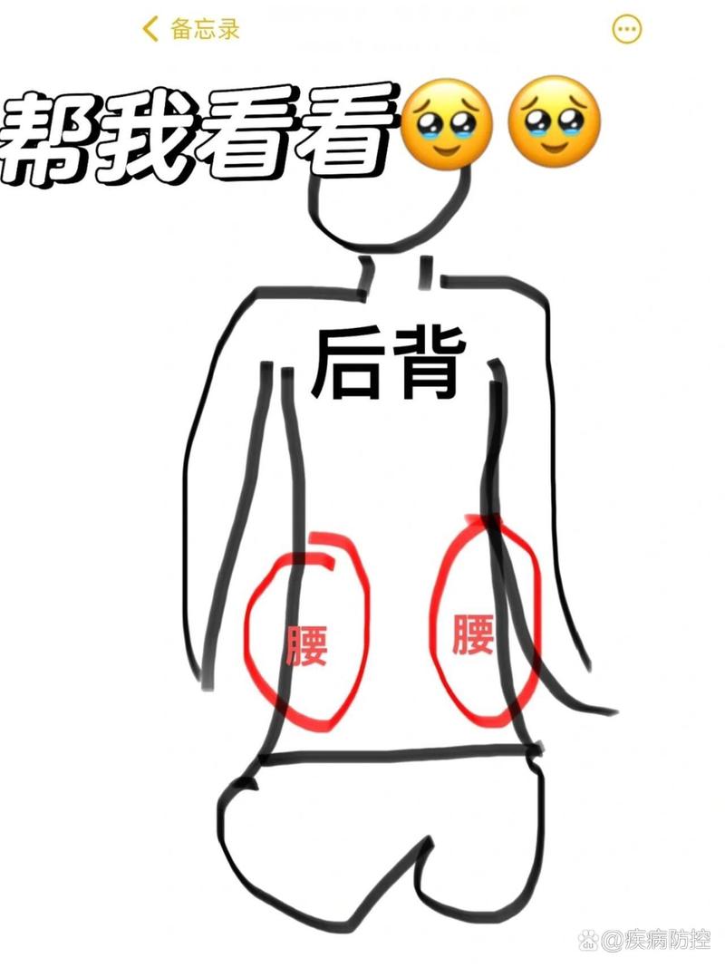 腰胀原因