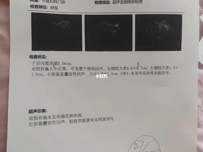 长卵泡不理想