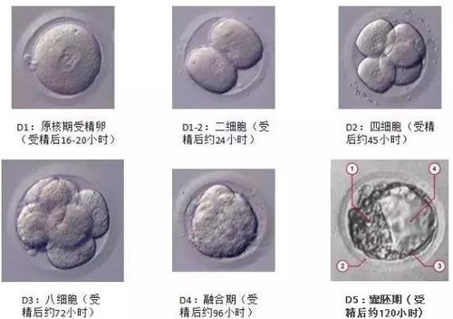 试管婴儿、囊胚培养、生殖医学