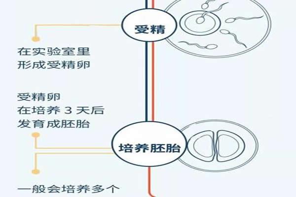试管婴儿全过程