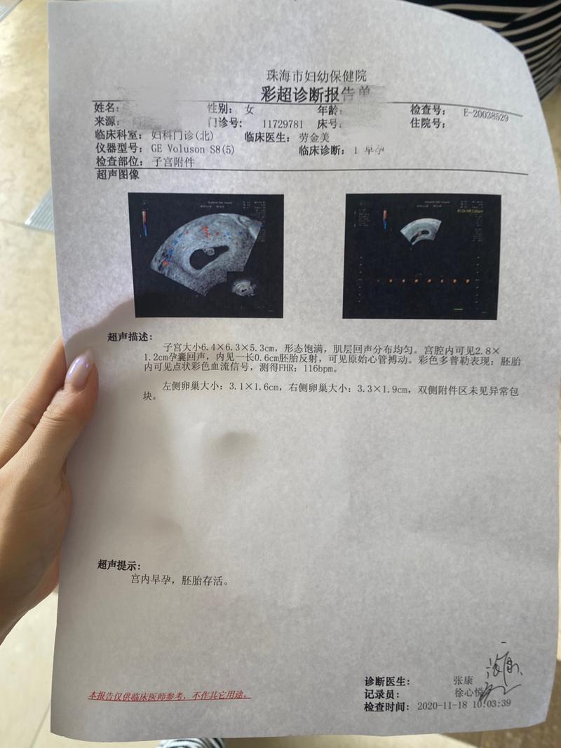 单胎怀孕