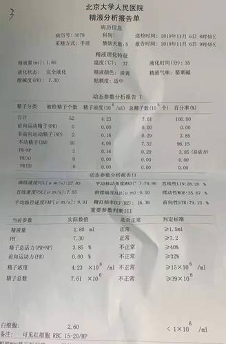 梗阻性无精子症