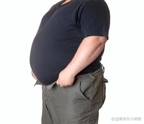 男性肥胖