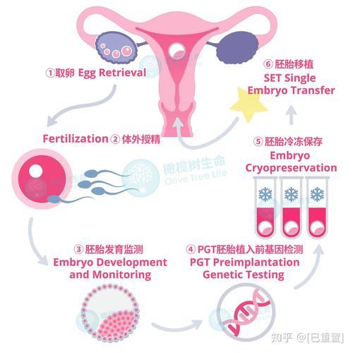 三代试管婴儿、胚胎发育、卵子质量、精子质量、实验室环境、胚胎培养技术