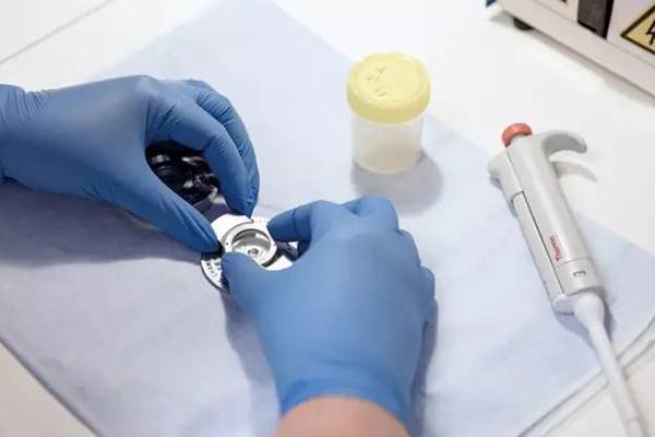 精子筛选