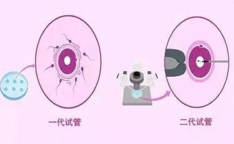 试管婴儿、新鲜胚胎 2 级、生殖医疗