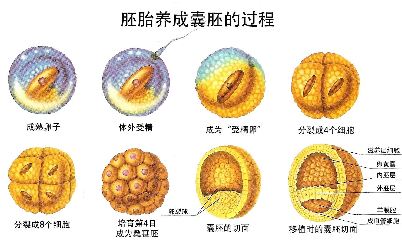 双胚移植