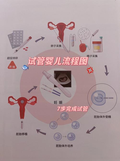 试管婴儿助孕过程
