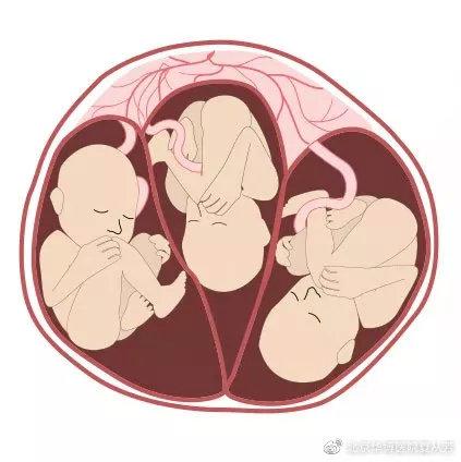 胚胎错换