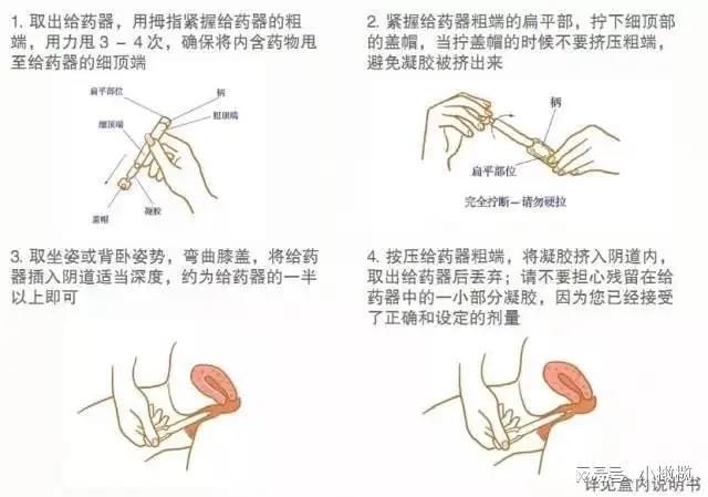  注意事项

<h1>试管婴儿过程中的打针时长与注意事项详解</h1>
<p>大家好，今天我们来聊聊一个非常重要的话题——试管婴儿过程中的打针时长与注意事项。对于很多家庭来说，试管婴儿是实现生育梦想的最后希望。在这个过程中，打针是一个必不可少的环节。那么，打针究竟需要多长时间？又有哪些注意事项呢？接下来，就让我们一起来详细了解一下。</p>

<h2>打针时长</h2>
<p>试管婴儿过程中的打针时长因个人情况而异。一般来说，从开始促排卵到取卵，大约需要10-14天。这个过程中，患者需要每天注射促排卵药物