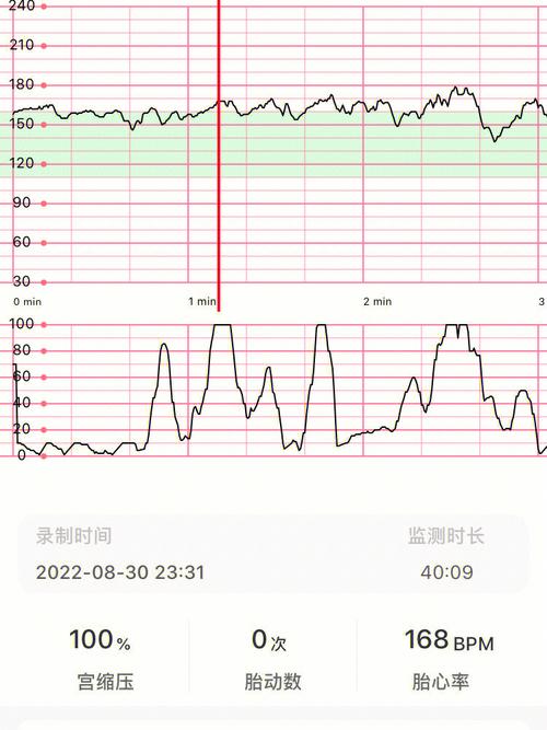 查胎心时间