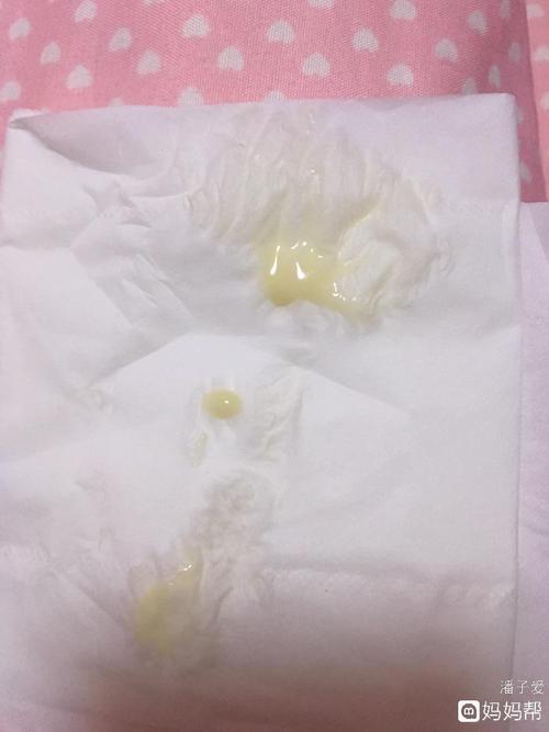 白带现象