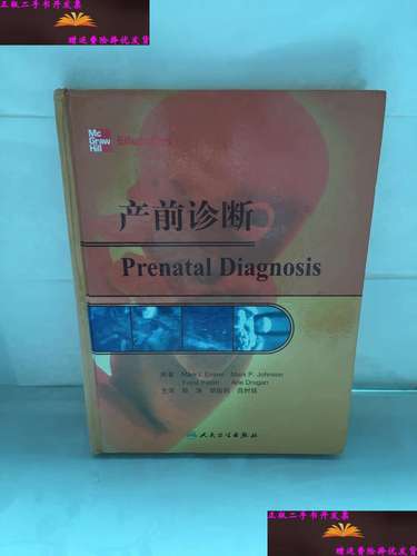 产前诊断