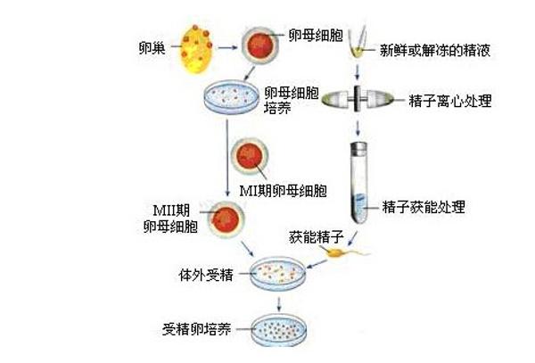 试管婴儿技术、一代试管婴儿、生殖医学、辅助生殖