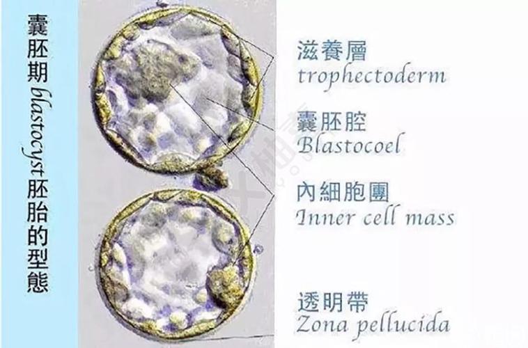 试管婴儿、囊胚移植、生殖医学、单胎妊娠