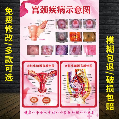 生殖系统健康