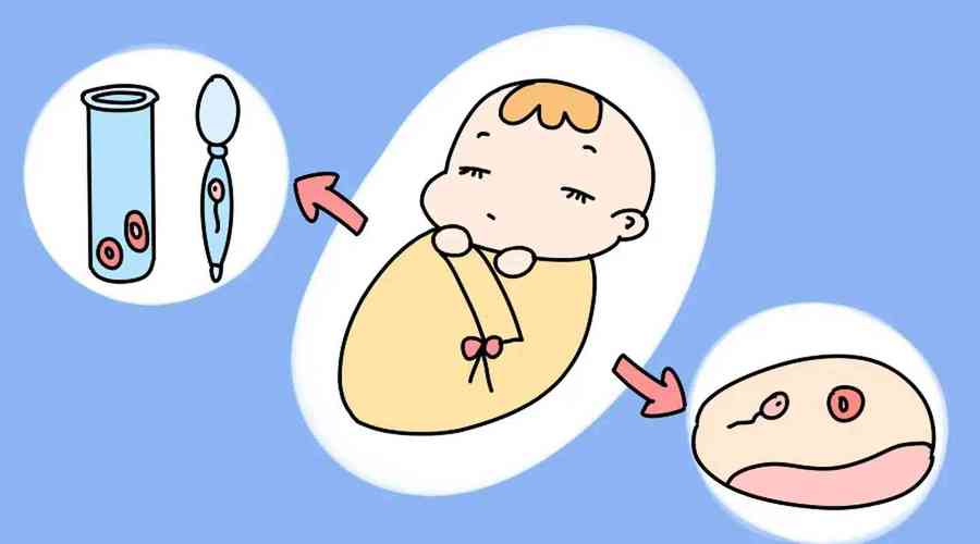 二胎试管婴儿