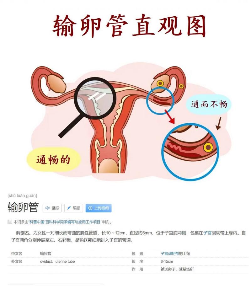 输卵管通畅