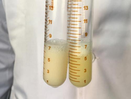  精子采集