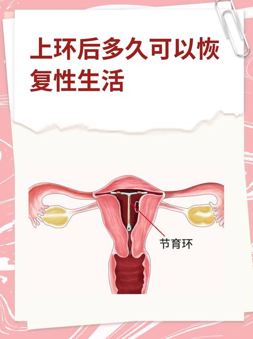  恢复同房
