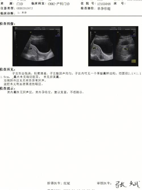 孕 6 周无胎心