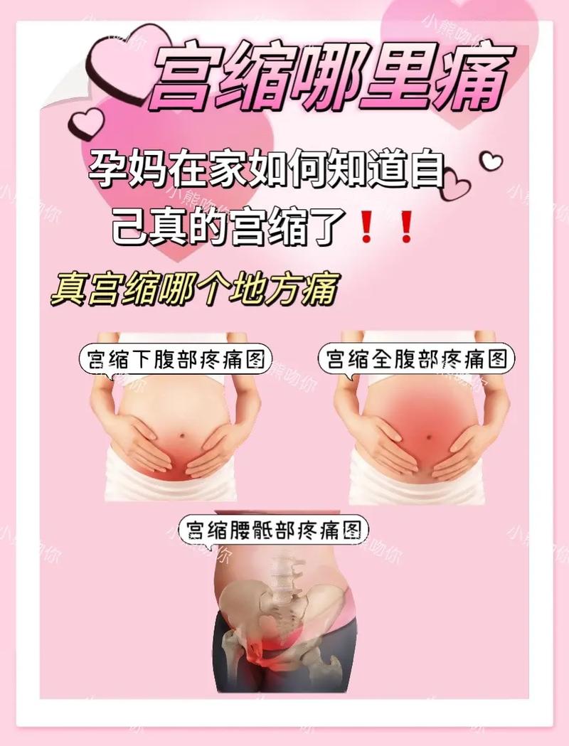 宫缩疼