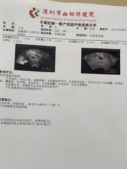 5 周胎心弱