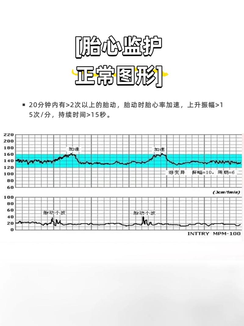 胎心正常