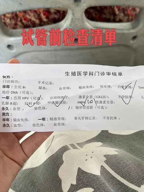 短时IVF