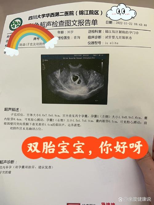 <双胞胎移植>