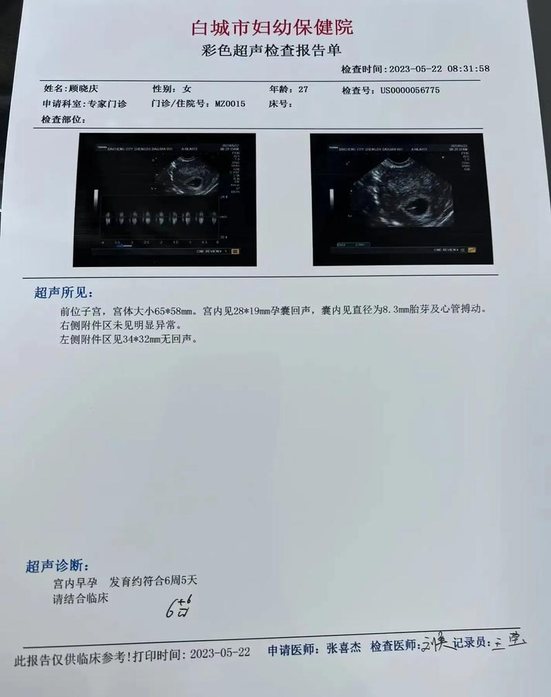 怀孕确诊
