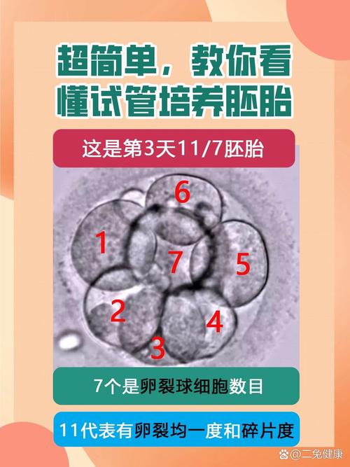 试管婴儿早期