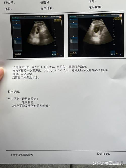 胚胎检查