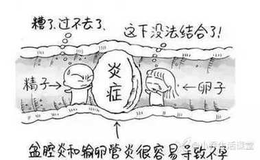 输卵管闭塞