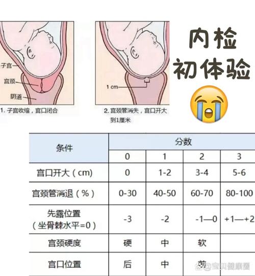 子宫条件