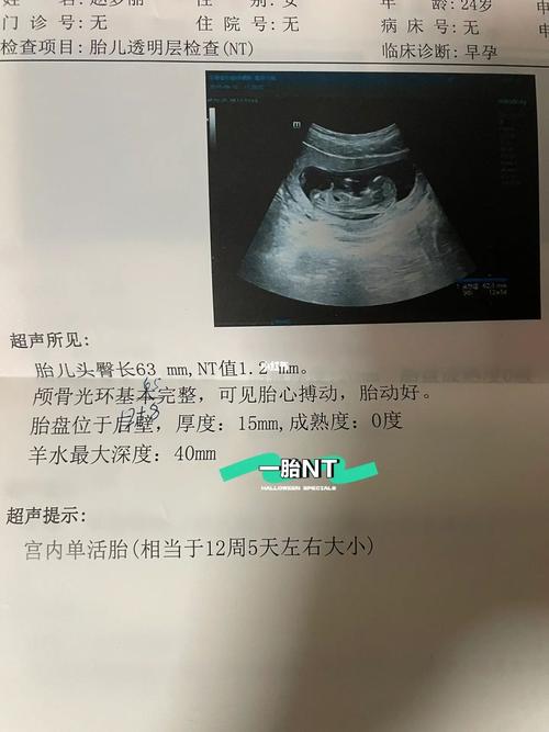 单胎区别