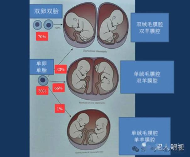 双胎形成