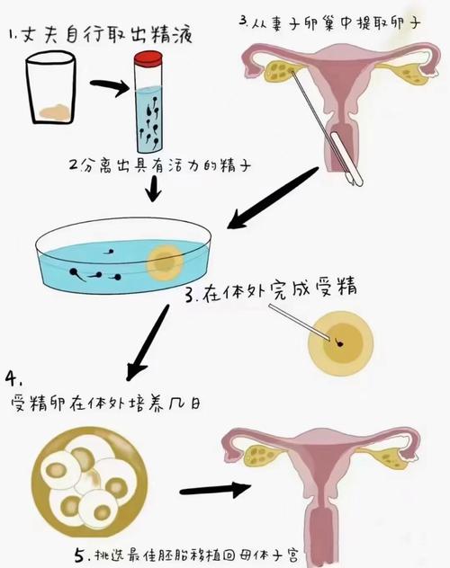  注意事项

<h1>泰国捐卵试管婴儿：成功之路与注意事项</h1>

<p>在生殖医学领域，泰国以其先进的技术和相对宽松的法律环境而闻名。对于许多寻求捐卵试管婴儿（IVF）的家庭来说，泰国成为了一个热门的选择。今天，我们就来聊聊泰国捐卵试管婴儿的成功之路以及在这一过程中需要注意的事项。</p>

<h2>泰国捐卵试管婴儿的成功率</h2>

<p>根据泰国健康部门2019年的统计数据，泰国捐卵试管婴儿的成功率约为55%至60%。这个数字相较于其他国家来说相对较高，但值得注意的是，成功率受多种因素影响，包