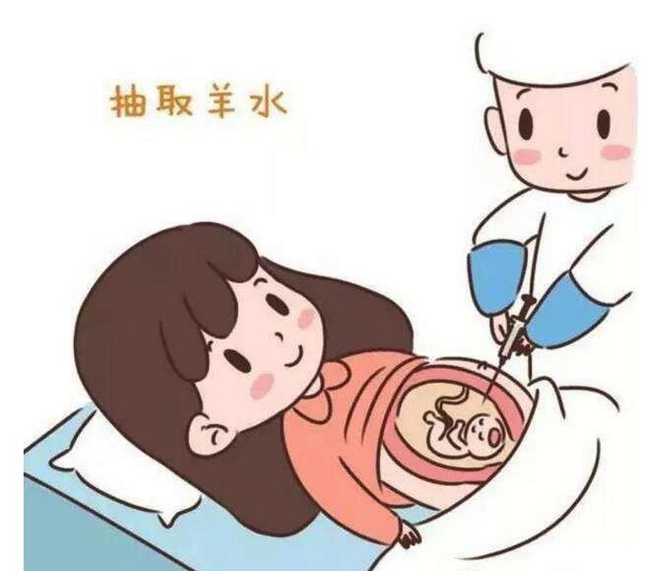 羊膜穿刺