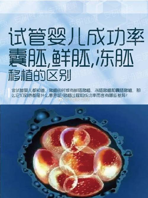 试管婴儿、鲜胚双胞胎、医疗技术、生殖健康