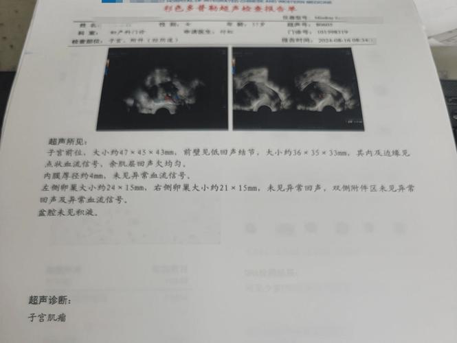 内膜厚度 7mm