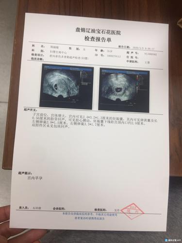 厦门试管婴儿移植