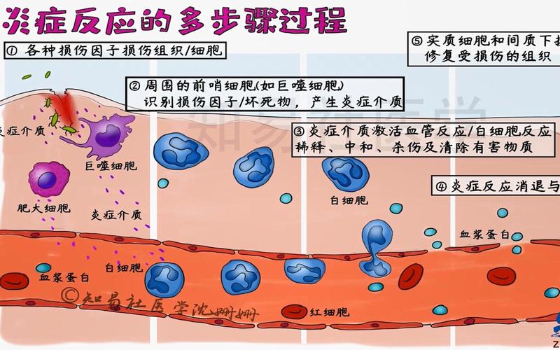 炎症反应