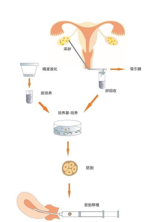 试管婴儿、胚胎发育、医疗技术