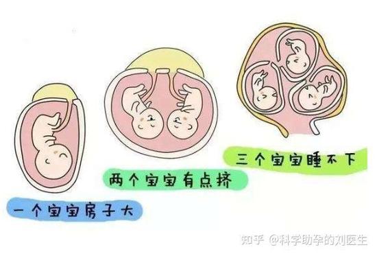 试管婴儿、双胞胎、智障、遗传因素、多胎妊娠
